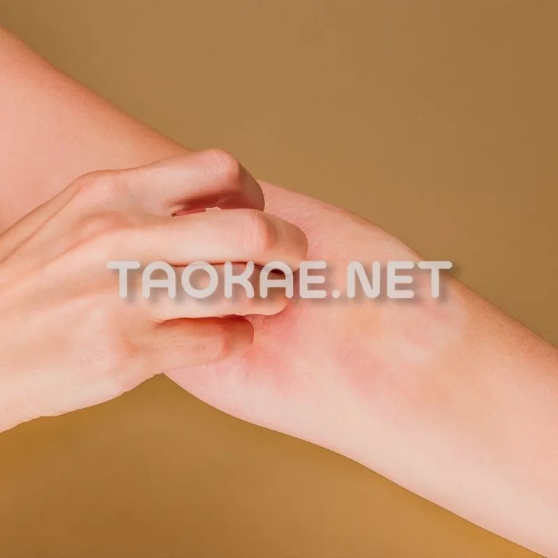 วิธีแก้พิษเบื้องต้น