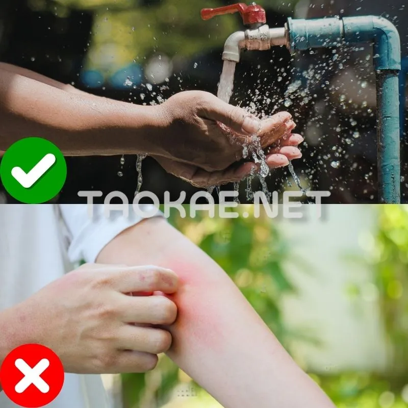 ปูนขาวสัมผัสผิวหนัง